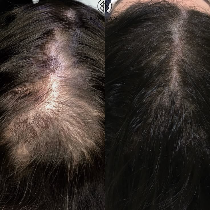 Peptide Hair Growth Serum